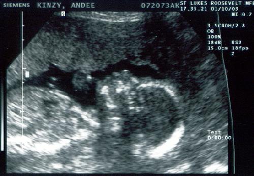 Zia In the Belly picture